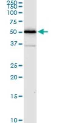 Western Blot: ALDH4A1 Antibody (1A12-A5) [H00008659-M01] - ALDH4A1 monoclonal antibody (M01), clone 1A12-A5. Analysis of ALDH4A1 expression in A-431.