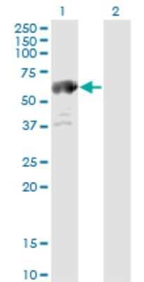 Western Blot: ALDH4A1 Antibody (1A12-A5) [H00008659-M01] - Analysis of ALDH4A1 expression in transfected 293T cell line by ALDH4A1 monoclonal antibody (M01), clone 1A12-A5.Lane 1: ALDH4A1 transfected lysate(61.7 KDa).Lane 2: Non-transfected lysate.