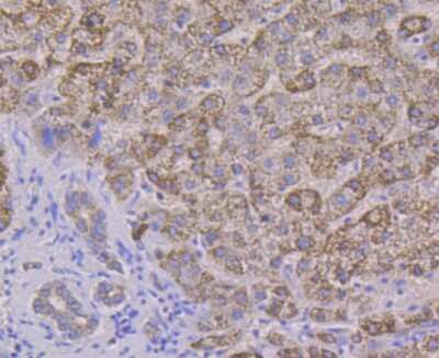 Immunohistochemistry-Paraffin: ALDH4A1 Antibody (7E2) [NBP2-75400] - Analysis of paraffin-embedded human liver tissue using anti-ALDH4A1 antibody. Counter stained with hematoxylin.