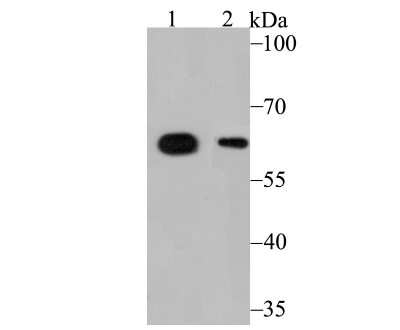 Western Blot: ALDH4A1 Antibody (7E2) [NBP2-75400] - Analysis of ALDH4A1 on SK-Br-3 (1) and HepG2 (2) cell lysate using anti-ALDH4A1 antibody at 1/1,000 dilution.