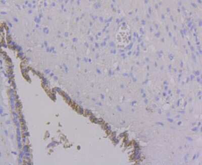 Immunohistochemistry-Paraffin: ALDH4A1 Antibody (7E3) [NBP2-75401] - Analysis of paraffin-embedded human prostate tissue using anti-ALDH4A1 antibody. Counter stained with hematoxylin.