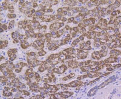 Immunohistochemistry-Paraffin: ALDH4A1 Antibody (7E3) [NBP2-75401] - Analysis of paraffin-embedded human liver tissue using anti-ALDH4A1 antibody. Counter stained with hematoxylin.