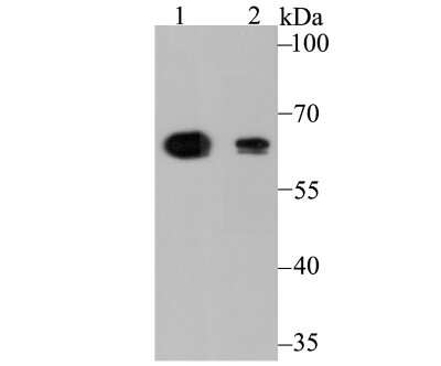 Western Blot: ALDH4A1 Antibody (7E3) [NBP2-75401] - Analysis of ALDH4A1 on SK-Br-3 (1) and HepG2 (2) cell lysate using anti-ALDH4A1 antibody at 1/1,000 dilution.