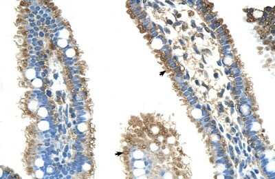 Immunohistochemistry-Paraffin: ALDH4A1 Antibody [NBP1-54739] - Human Intestine Tissue, antibody concentration 4-8ug/ml. Cells with positive label: Epithelial cells of intestinal villus (indicated with arrows) 400X magnification.