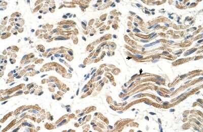 Immunohistochemistry-Paraffin: ALDH4A1 Antibody [NBP1-54740] - Human Muscle Tissue, Skeletal muscle cells (Indicated with Arrows) 4-8ug/ml.