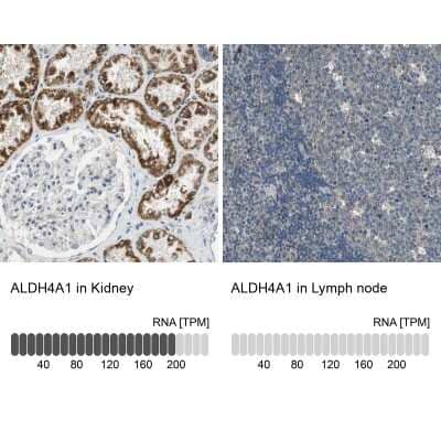 Immunohistochemistry-Paraffin: ALDH4A1 Antibody [NBP1-89149] - Analysis in human kidney and lymph node tissues using NBP1-89149 antibody. Corresponding ALDH4A1 RNA-seq data are presented for the same tissues.