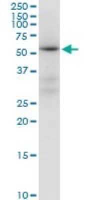 Western Blot: ALDH4A1 Antibody [H00008659-B01P] - Analysis of ALDH4A1 expression in HepG2.