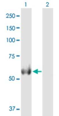 Western Blot: ALDH4A1 Antibody [H00008659-B01P] - Analysis of ALDH4A1 expression in transfected 293T cell line by ALDH4A1 polyclonal antibody.  Lane 1: ALDH4A1 transfected lysate(61.93 KDa). Lane 2: Non-transfected lysate.