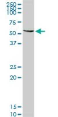 Western Blot: ALDH4A1 Antibody [H00008659-D01P] - Analysis of ALDH4A1 expression in HeLa.