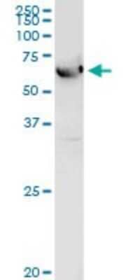 Western Blot: ALDH4A1 Antibody [H00008659-D01P] - Analysis of ALDH4A1 expression in human liver.