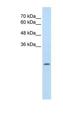 Western Blot: ALDH4A1 Antibody [NBP1-54739] - Titration: 2.5ug/ml Positive Control: HepG2 cell lysate.