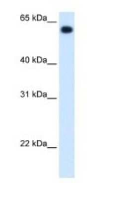 Western Blot: ALDH4A1 Antibody [NBP1-54740] - Titration: 1.25 ug/ml Positive Control: Fetal liver cell lysate.