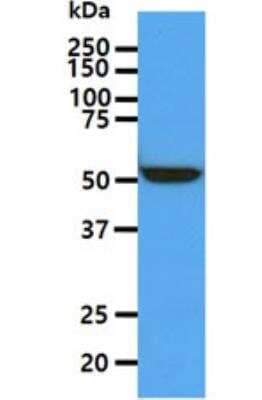 Western Blot: ALDH5A1 Antibody (17F5) [NBP2-59409] - The HepG2 cell lysate (40ug) were resolved by SDS-PAGE, transferred to PVDF membrane and probed with anti-human ALDH5A1 antibody (1:1000). Proteins were visualized using a goat anti-mouse secondary antibody conjugated to HRP and an ECL detection system.