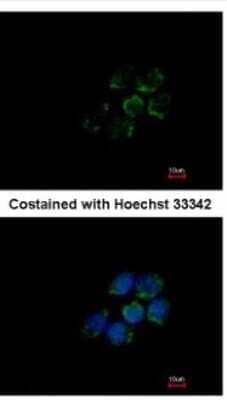 Immunocytochemistry/Immunofluorescence: ALDH5A1 Antibody [NBP1-32970] - Analysis of methanol-fixed A431, using antibody at 1:500 dilution.