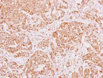 Immunohistochemistry-Paraffin: ALDH5A1 Antibody [NBP1-32970] - Paraffin-embedded A549 xenograft, using antibody at 1:500 dilution.