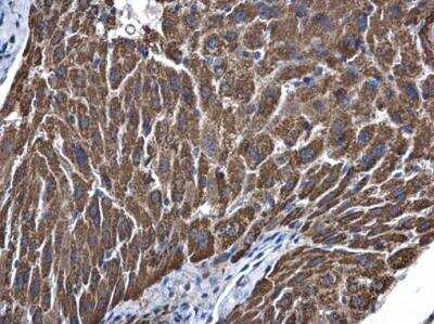 Immunohistochemistry-Paraffin: ALDH5A1 Antibody [NBP1-32970] - ALDH5A1 antibody detects ALDH5A1 protein at mitochondria in mouse liver by immunohistochemical analysis. Sample: Paraffin-embedded mouse liver. ALDH5A1 antibody diluted at 1:500.