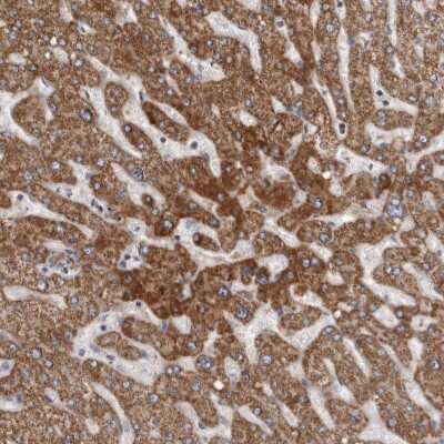 Immunohistochemistry-Paraffin: ALDH5A1 Antibody [NBP1-86997] - Staining of human liver shows high expression.