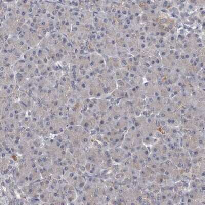 Immunohistochemistry-Paraffin: ALDH5A1 Antibody [NBP1-86997] - Staining of human pancreas shows low expression as expected.