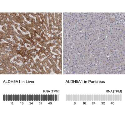 <b>Independent Antibodies Validation and Orthogonal Strategies Validation.</b>Immunohistochemistry-Paraffin: ALDH5A1 Antibody [NBP1-86997] - Staining in human liver and pancreas tissues using anti-ALDH5A1 antibody. Corresponding ALDH5A1 RNA-seq data are presented for the same tissues.