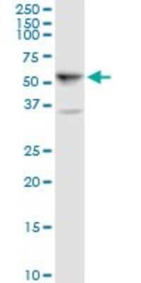 Western Blot: ALDH5A1 Antibody [H00007915-B01P] - Analysis of ALDH5A1 expression in K-562.