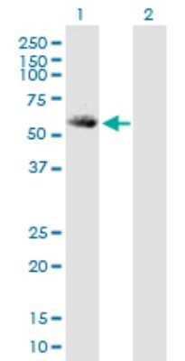 Western Blot: ALDH5A1 Antibody [H00007915-B01P] - Analysis of ALDH5A1 expression in transfected 293T cell line by ALDH5A1 polyclonal antibody.  Lane 1: ALDH5A1 transfected lysate(58.85 KDa). Lane 2: Non-transfected lysate.