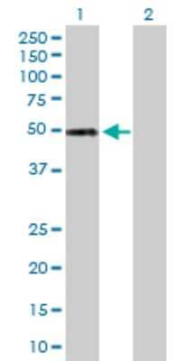 Western Blot: ALDH5A1 Antibody [H00007915-D01P] - Analysis of ALDH5A1 expression in transfected 293T cell line by ALDH5A1 polyclonal antibody.Lane 1: ALDH5A1 transfected lysate(57.20 KDa).Lane 2: Non-transfected lysate.