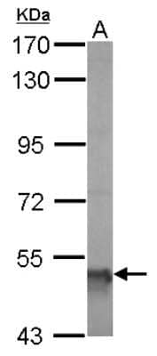 Western Blot: ALDH5A1 Antibody [NBP1-32970] - Sample (20 ug of whole cell lysate) A: mouse brain 7. 5% SDS PAGE; antibody diluted at 1:5000.