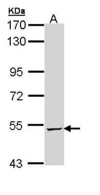 Western Blot: ALDH5A1 Antibody [NBP1-32970] - Sample (30 ug of whole cell lysate) A: A431 7. 5% SDS PAGE; antibody diluted at 1:1000.