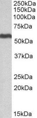 Western Blot: ALDH5A1 Antibody [NBP1-52099] (0.5ug/ml) staining of Human Liver lysate (35ug protein in RIPA buffer). Primary incubation was 1 hour. Detected by chemiluminescence.