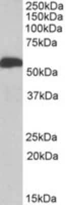 Western Blot: ALDH5A1 Antibody [NBP1-52100] - Analysis of ALDH5A1 (aa 301-312) in Human Liver lysate (35 ug protein in RIPA buffer) using NBP1-52100 at 1ug/mL. Primary incubation was 1 hour. Detected by chemiluminescence.