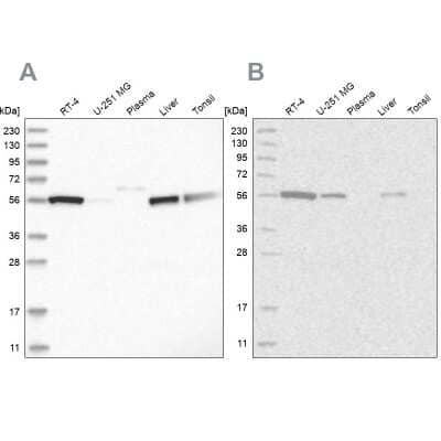 Western Blot: ALDH5A1 Antibody [NBP1-86997] - Analysis using Anti-ALDH5A1 antibody NBP1-86997 (A) shows similar pattern to independent antibody NBP1-86996 (B).