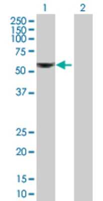 Western Blot: ALDH6A1 Antibody [H00004329-B01P] - Analysis of ALDH6A1 expression in transfected 293T cell line by ALDH6A1 polyclonal antibody.  Lane 1: ALDH6A1 transfected lysate(58.85 KDa). Lane 2: Non-transfected lysate.