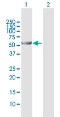 Western Blot: ALDH6A1 Antibody [H00004329-D01P] - Analysis of ALDH6A1 expression in transfected 293T cell line by ALDH6A1 polyclonal antibody.Lane 1: ALDH6A1 transfected lysate(57.80 KDa).Lane 2: Non-transfected lysate.