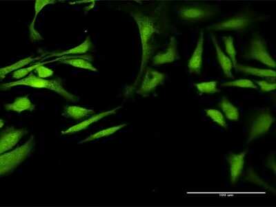 Immunocytochemistry/Immunofluorescence: ALDH7A1 Antibody [H00000501-D01P] - Analysis of antibody to ALDH7A1 on HeLa cell. Antibody concentration 20 ug/ml.