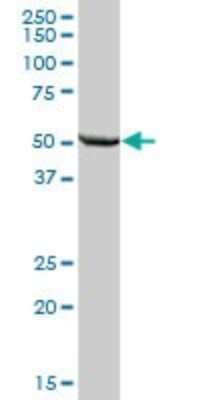 Western Blot: ALDH7A1 Antibody [H00000501-B01P] - Analysis of ALDH7A1 expression in human liver.