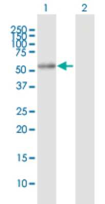 Western Blot: ALDH7A1 Antibody [H00000501-B01P] - Analysis of ALDH7A1 expression in transfected 293T cell line by ALDH7A1 polyclonal antibody.  Lane 1: ALDH7A1 transfected lysate(56.21 KDa). Lane 2: Non-transfected lysate.
