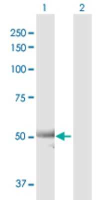 Western Blot: ALDH7A1 Antibody [H00000501-D01P] - Analysis of ALDH7A1 expression in transfected 293T cell line by ALDH7A1 polyclonal antibody.Lane 1: ALDH7A1 transfected lysate(55.40 KDa).Lane 2: Non-transfected lysate.