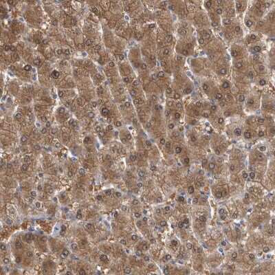 Immunohistochemistry-Paraffin: ALDH8A1 Antibody [NBP1-89151] - Staining of human liver shows high expression.