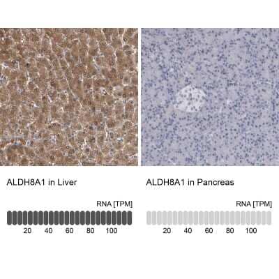 <b>Orthogonal Strategies Validation. </b>Immunohistochemistry-Paraffin: ALDH8A1 Antibody [NBP1-89151] - Staining in human liver and pancreas tissues using anti-ALDH8A1 antibody. Corresponding ALDH8A1 RNA-seq data are presented for the same tissues.