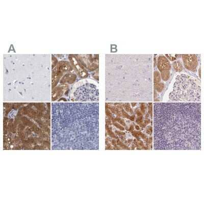 <b>Independent Antibodies Validation. </b>Immunohistochemistry-Paraffin: ALDH8A1 Antibody [NBP1-89151] - Staining of human cerebral cortex, kidney, liver and lymph node using Anti-ALDH8A1 antibody NBP1-89151 (A) shows similar protein distribution across tissues to independent antibody NBP2-38753 (B).