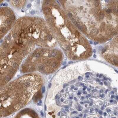 Immunohistochemistry-Paraffin: ALDH8A1 Antibody [NBP1-89151] - Staining of human kidney.