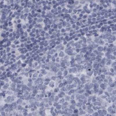 Immunohistochemistry-Paraffin ALDH8A1 Antibody