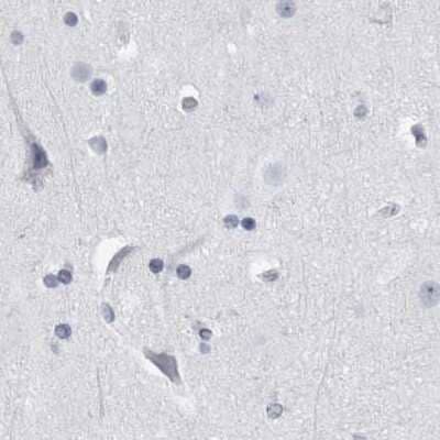 Immunohistochemistry-Paraffin: ALDH8A1 Antibody [NBP1-89151] - Staining of human cerebral cortex.