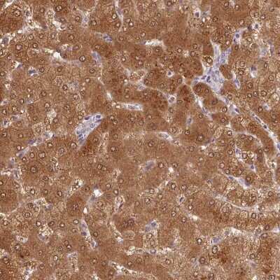 Immunohistochemistry-Paraffin ALDH8A1 Antibody