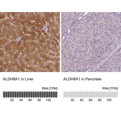 Immunohistochemistry-Paraffin ALDH8A1 Antibody