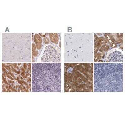 Immunohistochemistry-Paraffin: ALDH8A1 Antibody [NBP2-38753] - Staining of human cerebral cortex, kidney, liver and lymph node using Anti-ALDH8A1 antibody NBP2-38753 (A) shows similar protein distribution across tissues to independent antibody NBP1-89151 (B).