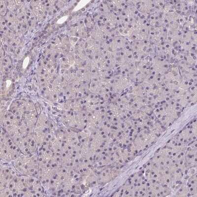 Immunohistochemistry-Paraffin: ALDH8A1 Antibody [NBP2-38753] - Staining of human pancreas shows low expression as expected.