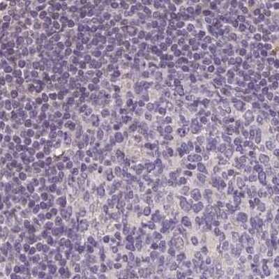 Immunohistochemistry-Paraffin: ALDH8A1 Antibody [NBP2-38753] - Staining of human lymph node.