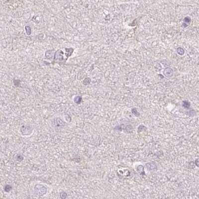 Immunohistochemistry-Paraffin: ALDH8A1 Antibody [NBP2-38753] - Staining of human cerebral cortex.