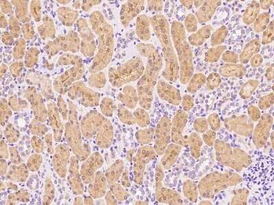 Immunohistochemistry-Paraffin: ALDH8A1 Antibody [NBP2-99392] - Immunochemical staining of human ALDH8A1 in human kidney with rabbit polyclonal antibody at 1:1000 dilution, formalin-fixed paraffin embedded sections.